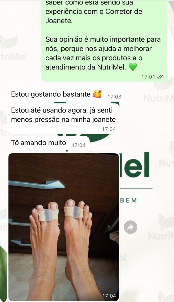 Cliente usando o corretor de joanete